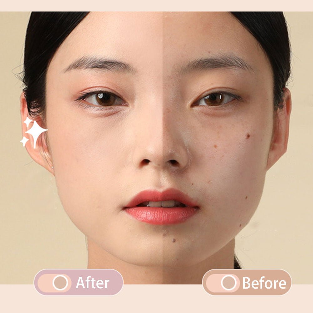 GOGOTALES Acne Marks Dark Circles Concealer - GOGOTALES粉底/遮瑕膏